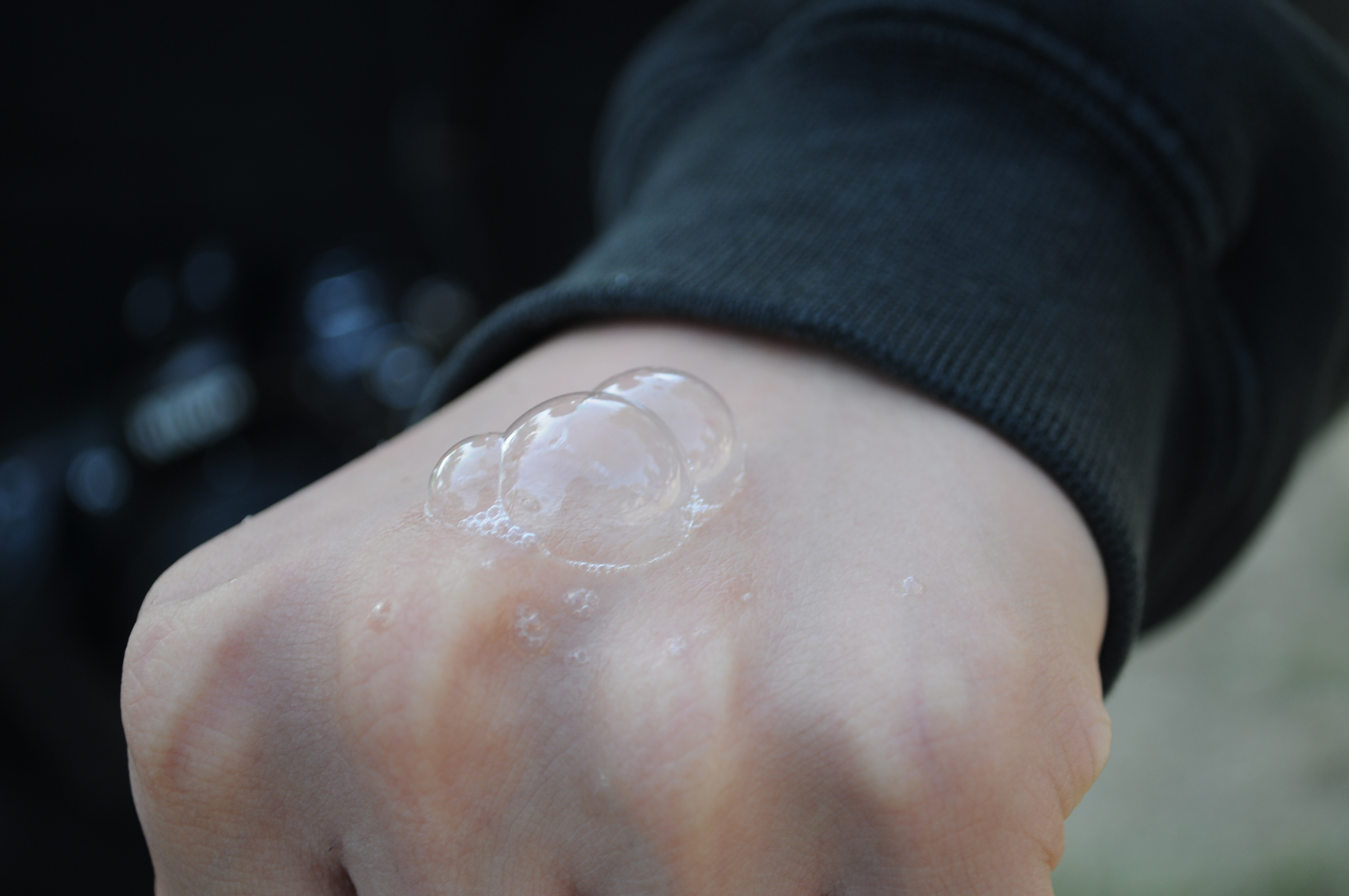 Bubbles on the back of a hand